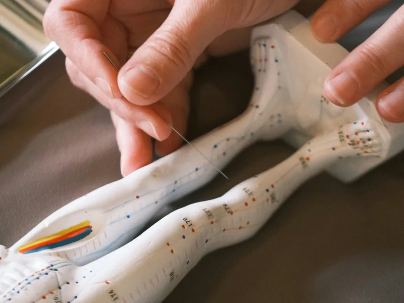 Acupuncture at Integrated Chiropractic in Defiance