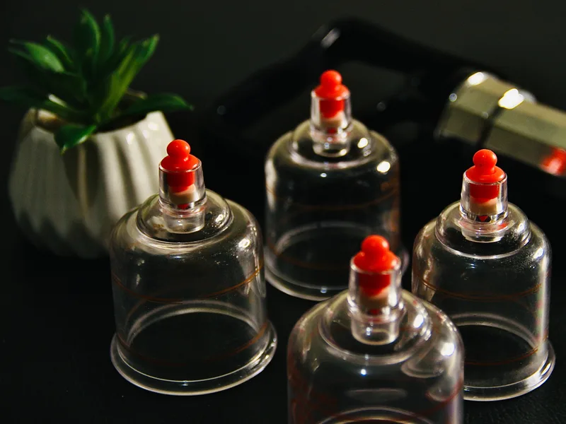 How Cupping Therapy works at Integrated Chiropractic