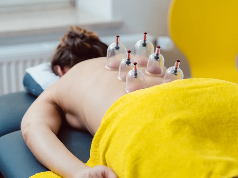 Cupping Therapy at Integrated Chiropractic in Defiance