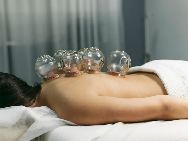 Cupping Therapy at Integrated Chiropractic in Defiance