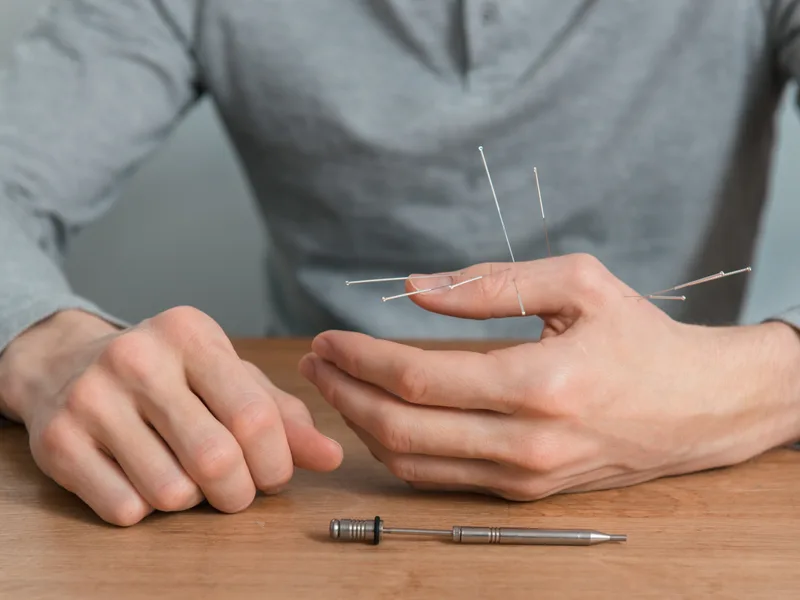Dry Needling at Integrated Chiropractic in Defiance