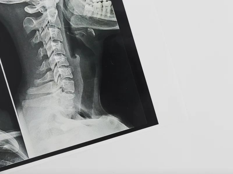 X-Rays at Integrated Chiropractic in Defiance