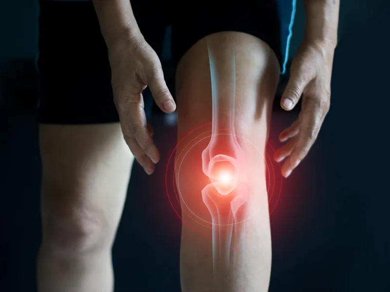How Integrated Chiropractic treats arthritis in Defiance